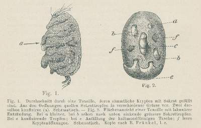 Bild Nr.2: 134-1405 Bering,E.v.: (Medizin)
