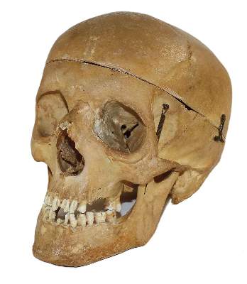 Bild Nr.2: 134-1454 Totenschädel,: (Medizin)