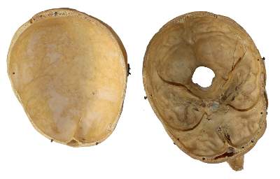 Bild Nr.3: 134-1454 Totenschädel,: (Medizin)