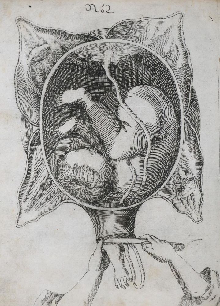 Große Abbildung Nr.1: 135-1724 Siegemundin,J.: (Medizin, Gynäkologie)