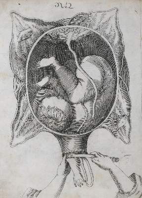 Bild Nr.1: 135-1724 Siegemundin,J.: (Medizin, Gynäkologie)