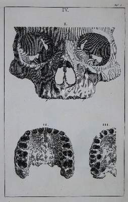 Bild Nr.1: 135-1779 Albinus,B.S.: (Verschiedene Gebiete - Varia)
