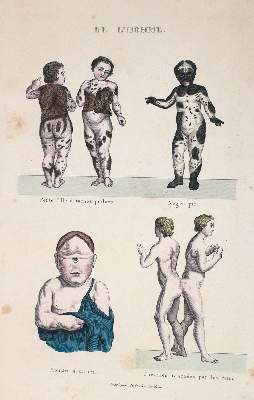 Bild Nr.1: 135-2739 Konvolut: (Varia, Medizin)