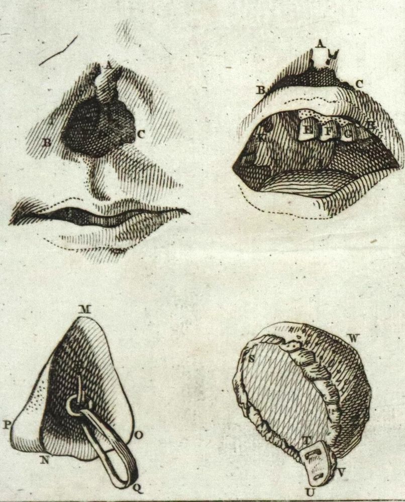 Große Abbildung Nr.1: 136-1453 (Camper,P.).: (Medizin)