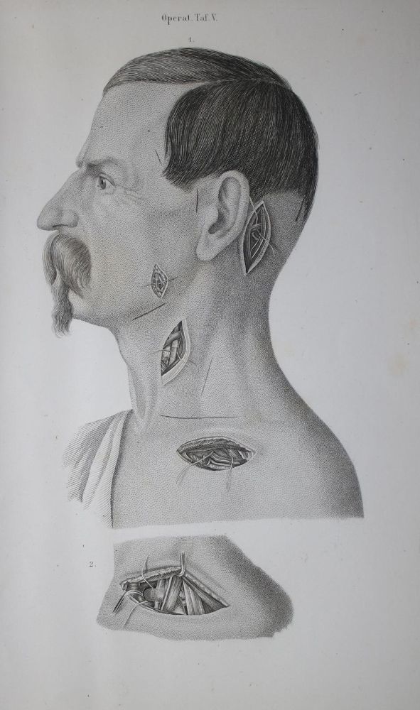 Große Abbildung Nr.1: 136-1455 Pitha,(F.)v. u. (C.A.)Billroth.: (Medizin, Chirurgie)