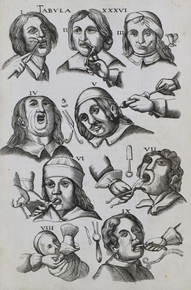 Große Abbildung Nr.1: 136-1522 Scultetus (Schultes),J.: (Medizin)