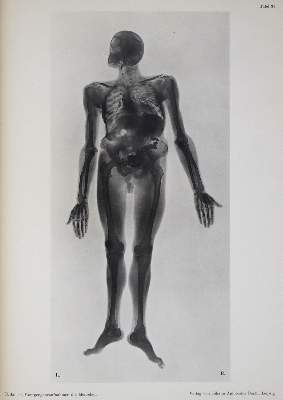 Bild Nr.2: 136-1471 Janker,R.: (Medizin)