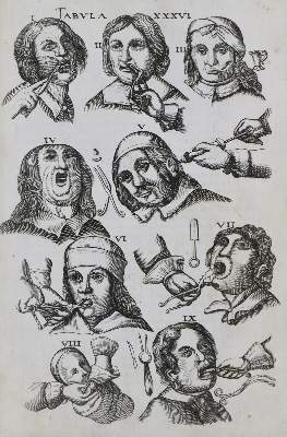 Bild Nr.1: 136-1522 Scultetus (Schultes),J.: (Medizin)