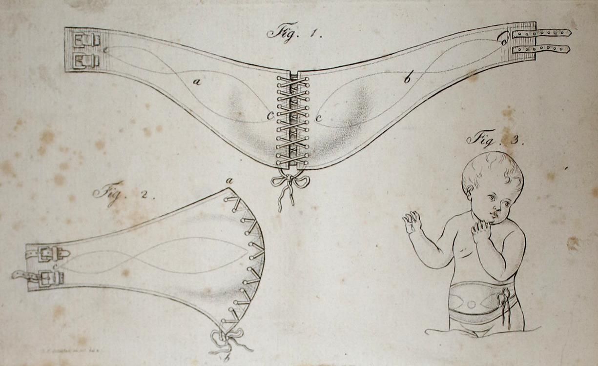Große Abbildung Nr.1: 137-1452 Jörg,J.C.G.: (Medizin, Gynäkologie)