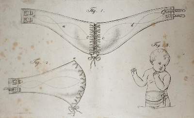 Bild Nr.1: 137-1452 Jörg,J.C.G.: (Medizin, Gynäkologie)