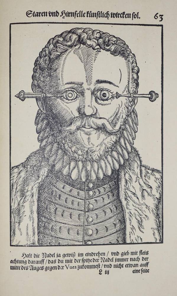 Große Abbildung Nr.3: 138-1677 Bartisch, Georg von Königsbrück.: (Medizin, Augenheilkunde)