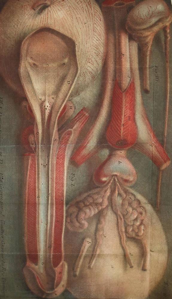 Große Abbildung Nr.1: 138-1689 Daran,J.: (Medizin, Chirurgie)