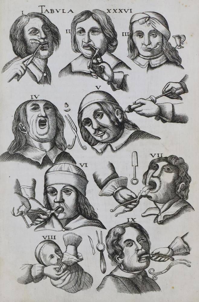 Große Abbildung Nr.1: 138-1737 Scultetus (Schultes),J.: (Medizin)