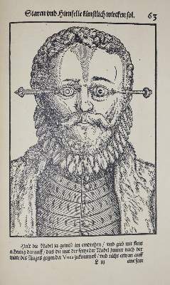 Bild Nr.3: 138-1677 Bartisch, Georg von Königsbrück.: (Medizin, Augenheilkunde)