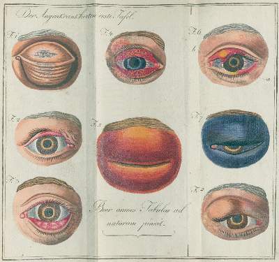 Bild Nr.3: 138-1682 Beer,J.G.: (Medizin)