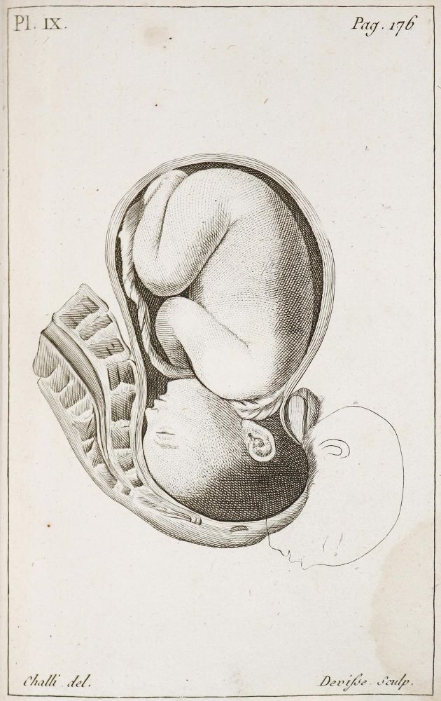 Große Abbildung Nr.1: 139-1513 Baudelocque,J.L.: (Medizin)