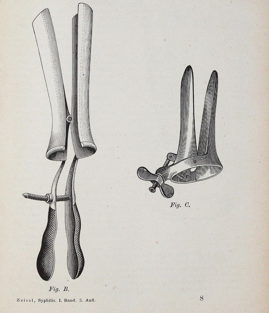 Große Abbildung Nr.1: 139-1580 Handschuch,G.F.: (Medizin, Syphilis)