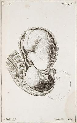 Bild Nr.1: 139-1513 Baudelocque,J.L.: (Medizin)
