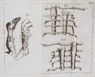 Bild Nr.3: 139-1515 Böttcher,J.F.: (Medizin)