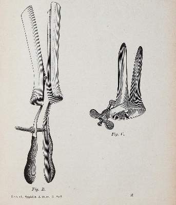 Bild Nr.1: 139-1580 Handschuch,G.F.: (Medizin, Syphilis)