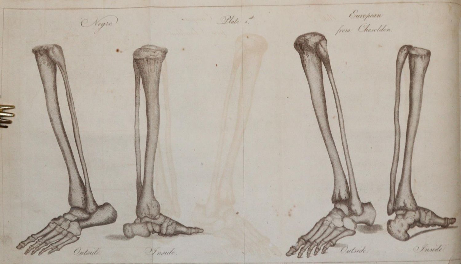 Große Abbildung Nr.2: 140-1781 White,C.: (Medizin, Anthropologie)