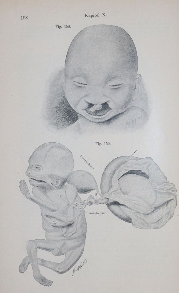 Große Abbildung Nr.4: 140-1861 Sammlung: (Medizin)