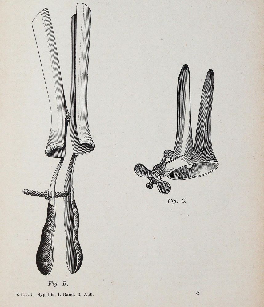 Große Abbildung Nr.1: 140-1872 Handschuch,G.F.: (Medizin, Syphilis)