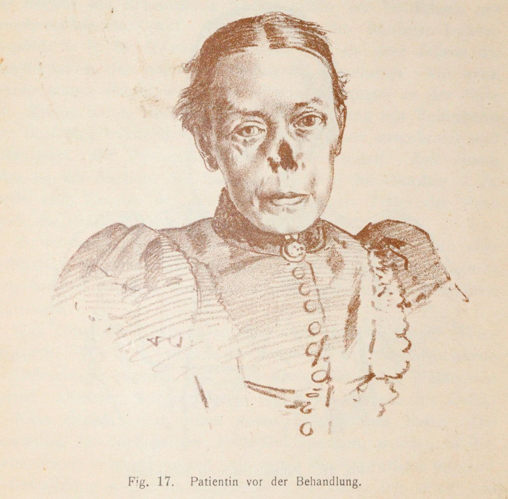 Große Abbildung Nr.2: 140-1881 Witzel,K.: (Medizin)