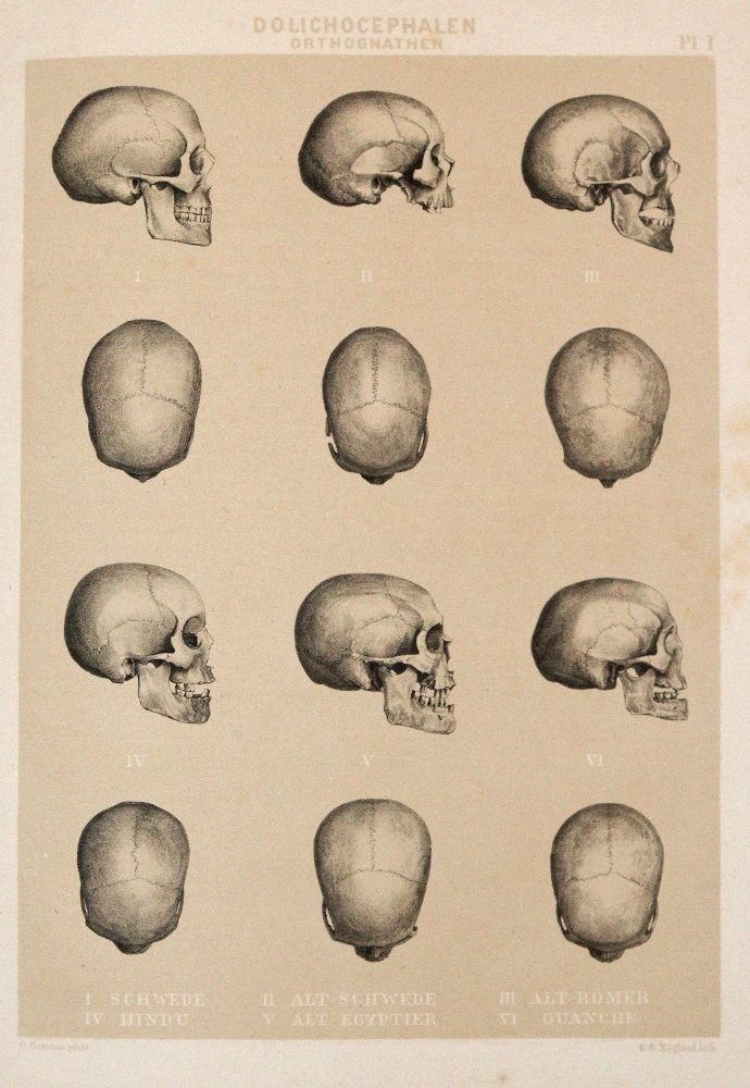 Große Abbildung Nr.3: 140-1953 Retzius,A.: (Verschiedene Gebiete - Varia, Anthropologie)