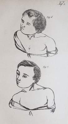 Bild Nr.2: 140-1796 Dieffenbach,J.F.: (Medizin)