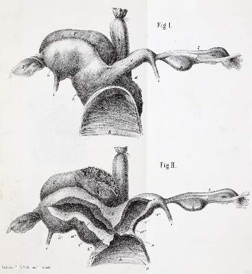 Bild Nr.1: 140-1809 Siebold,E.C.J.v.: (Medizin, Gynäkologie)