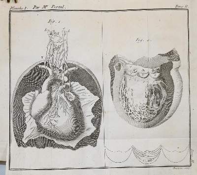 Bild Nr.3: 140-1836 Petit,(J.L.).: (Medizin)