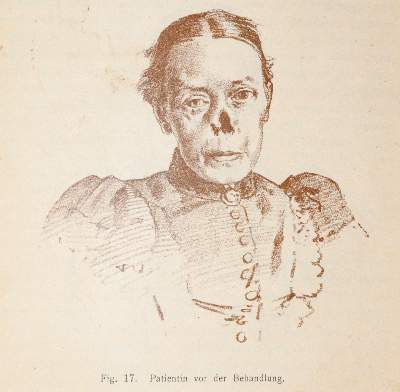 Bild Nr.2: 140-1881 Witzel,K.: (Medizin)