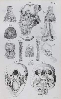 Große Abbildung Nr.2: 141-1651 Loder,J.C.: (Medizin, Anatomie)