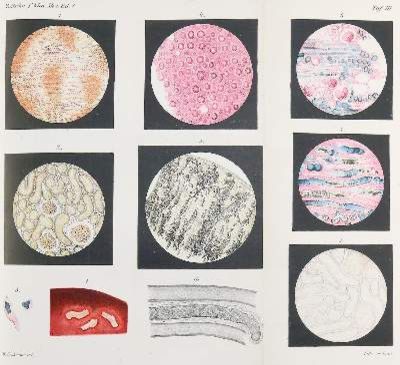 Große Abbildung Nr.1: 141-1667 Ehrlich,P.: (Medizin)