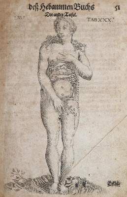 Große Abbildung Nr.1: 141-1673 Bourgeois,L.: (Medizin, Gynäkologie)