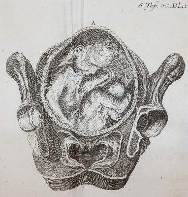 Große Abbildung Nr.5: 141-1674 Steidele,R.J.: (Medizin, Gynäkologie)