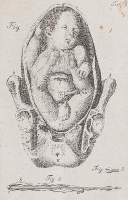 Große Abbildung Nr.2: 141-1711 Stein,G.W.: (Medizin)