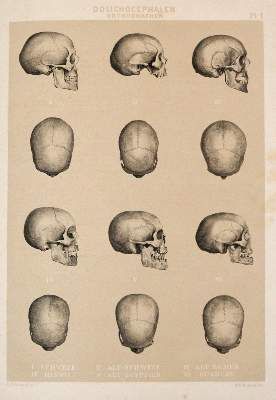 Große Abbildung Nr.3: 141-1769 Retzius,A.: (Verschiedene Gebiete - Varia, Anthropologie)