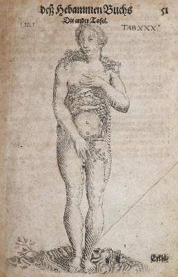 Bild Nr.1: 141-1673 Bourgeois,L.: (Medizin, Gynäkologie)