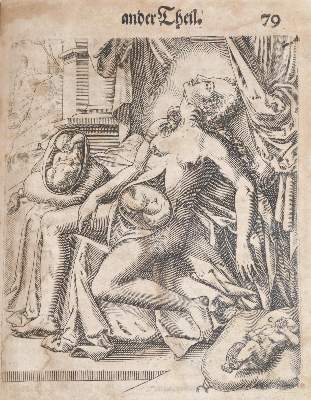 Bild Nr.3: 141-1673 Bourgeois,L.: (Medizin, Gynäkologie)