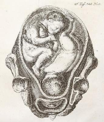 Bild Nr.1: 141-1674 Steidele,R.J.: (Medizin, Gynäkologie)