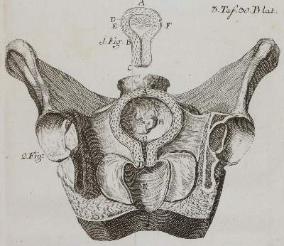 Bild Nr.3: 141-1674 Steidele,R.J.: (Medizin, Gynäkologie)