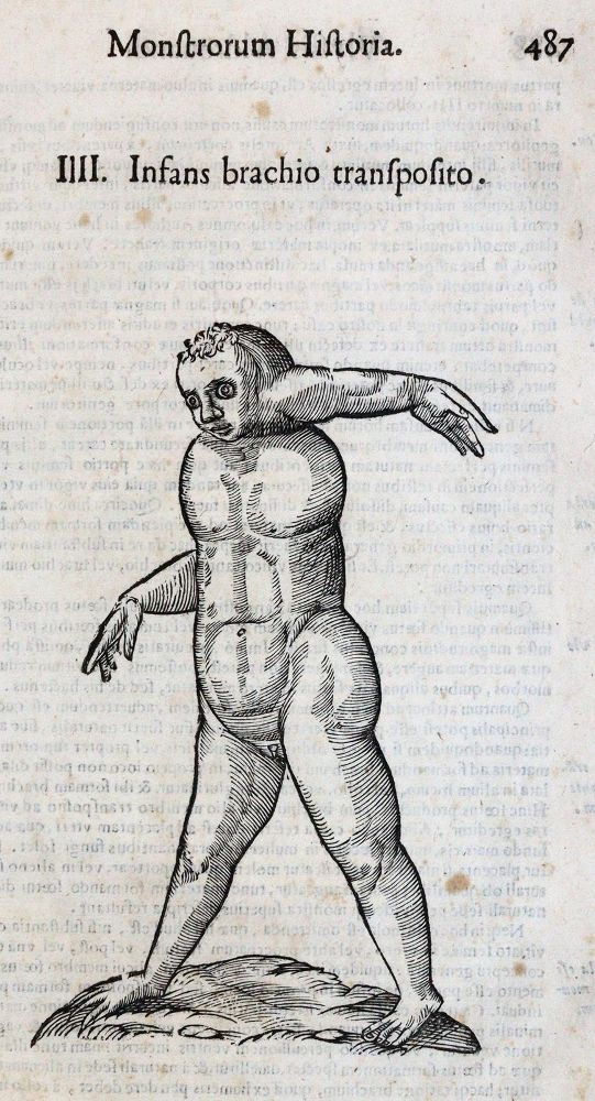 Große Abbildung Nr.2: 142-1879 Aldrovandi,U.: (Medizin)