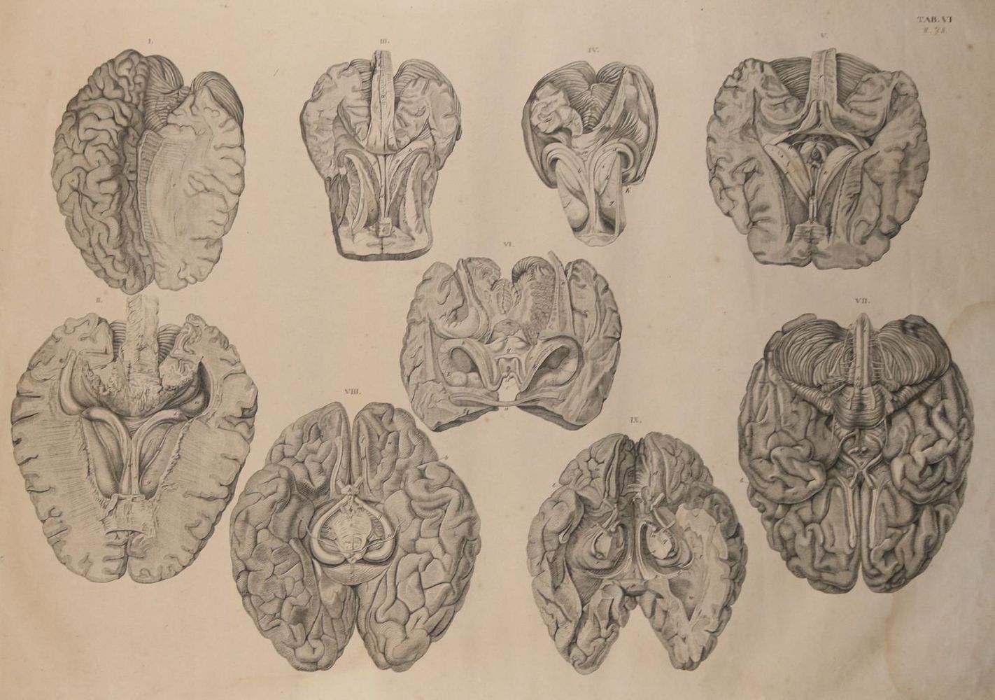 Große Abbildung Nr.24: 142-1881 Weber,M.I.: (Medizin, Anatomie)