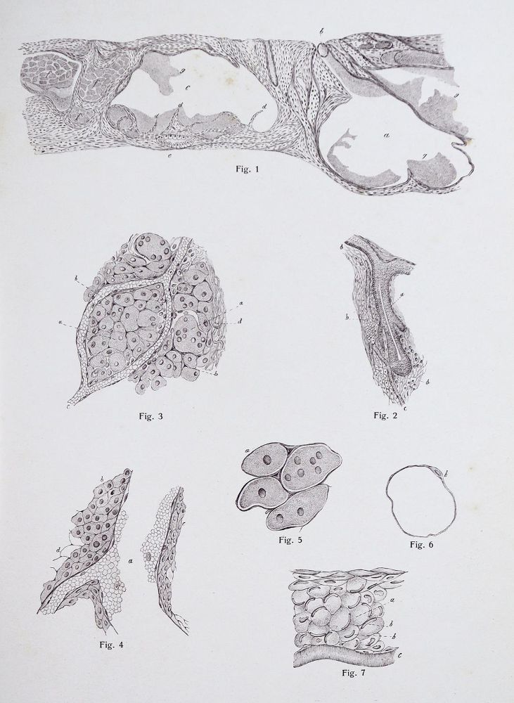 Große Abbildung Nr.2: 142-1882 Vincentiis,C.de.: (Medizin, Augenheilkunde)