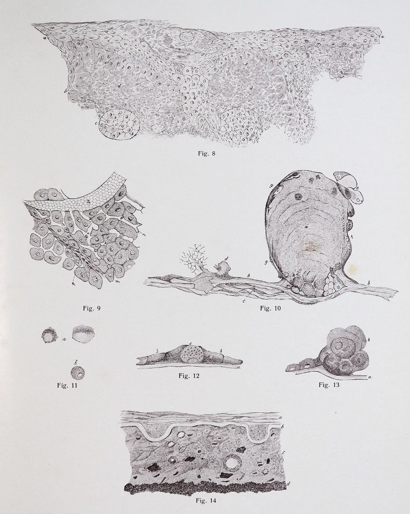 Große Abbildung Nr.3: 142-1882 Vincentiis,C.de.: (Medizin, Augenheilkunde)