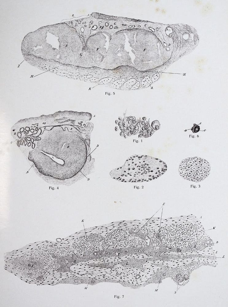 Große Abbildung Nr.4: 142-1882 Vincentiis,C.de.: (Medizin, Augenheilkunde)