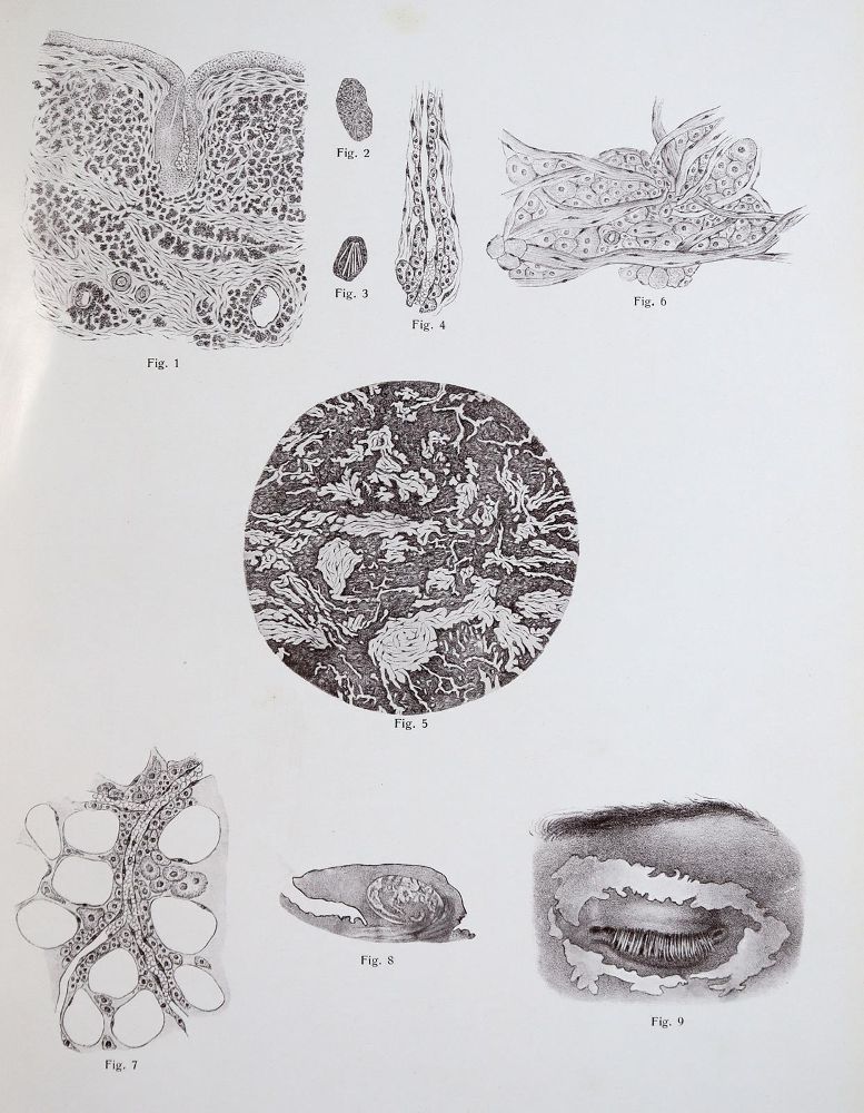 Große Abbildung Nr.6: 142-1882 Vincentiis,C.de.: (Medizin, Augenheilkunde)