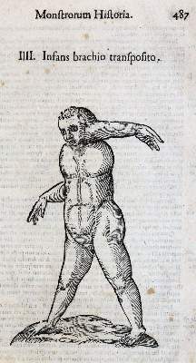 Bild Nr.2: 142-1879 Aldrovandi,U.: (Medizin)